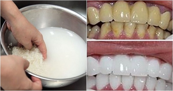 Cách làm trắng răng bằng Dùng nước vo gạo